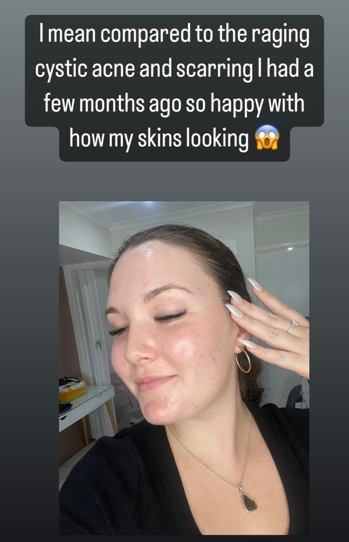 Alpha A serum 0.4% Retinol