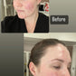 Alpha A serum 0.4% Retinol